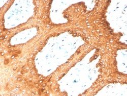Cytokeratin, HMW Antibody (KRTH/4392R) - Azide and BSA Free, Novus Biologicals 100 &mu;g | Buy Online | Novus Biologicals | Fisher Scientific